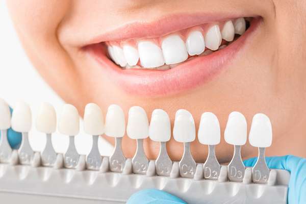 Ask a Cosmetic Dentist: What Are Veneers from Hemet Dental Center: Brian Stiewel DDS, INC. in Hemet, CA