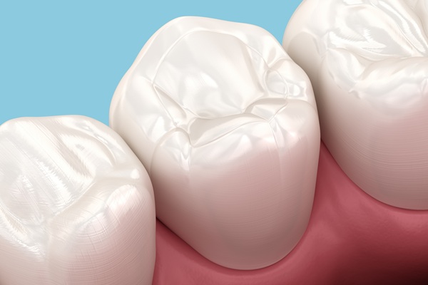 The Lifespan Of Composite Fillings And How To Care For Them