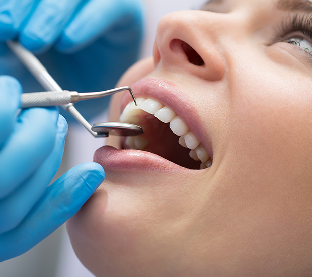 Hemet Dental Bonding
