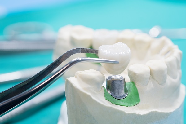 What Is A Dental Crown Restoration?