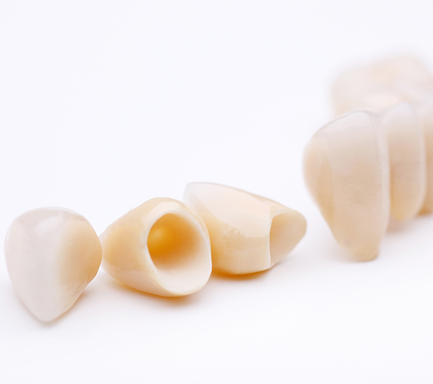 Hemet Dental Crowns and Dental Bridges