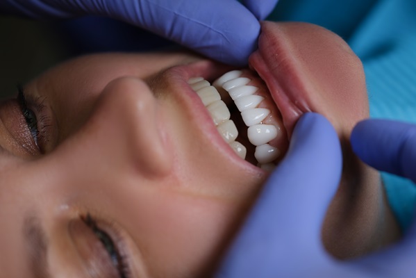 Oral Issues Your Dentist Looks For During A Dental Exam