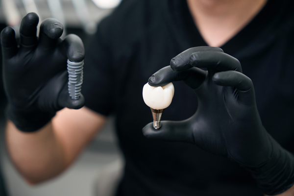 How Dental Implants Compare To Natural Teeth