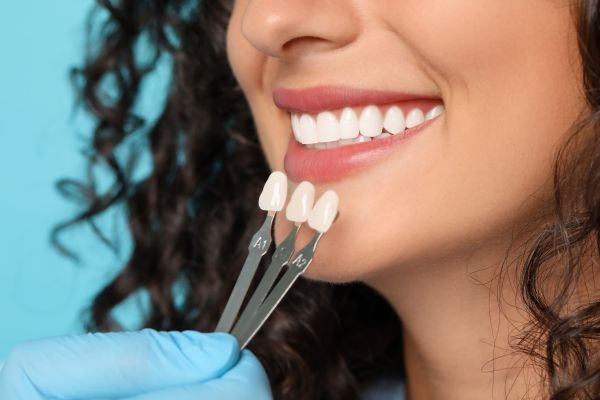 Dental Laminates: A Conservative Option For A Brighter, More Even Smile