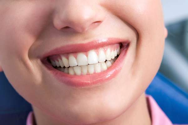 A General Dentist Discusses The Benefits Of Tooth Straightening