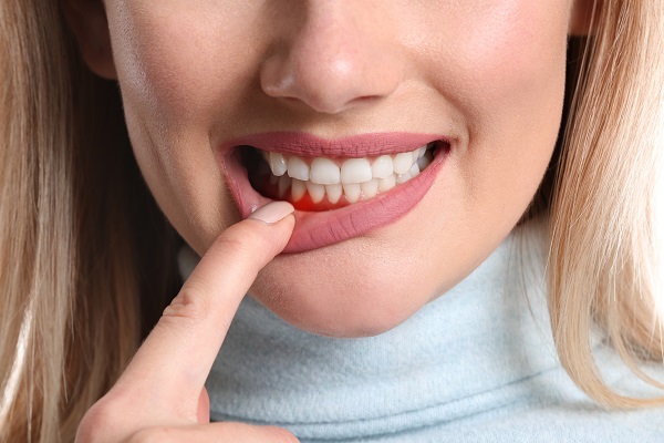 How Important Is Getting Checked For Gum Disease?