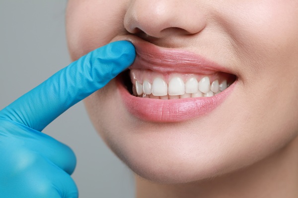 The Stages Of Gum Disease And When To Seek Treatment