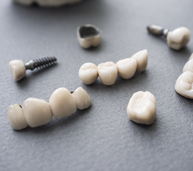Hemet The Difference Between Dental Implants and Mini Dental Implants