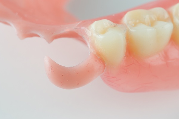 Finding The Replacement Option For Your Missing Tooth
