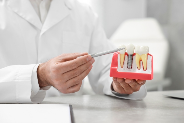 The Process Of Receiving Dental Implants From An Implant Dentist