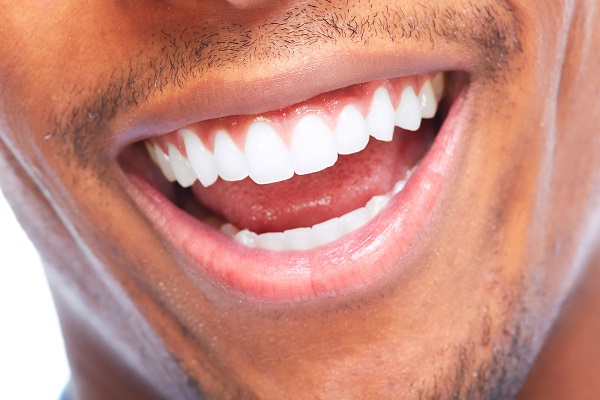 What Options Are Available For A Crooked Teeth Smile Makeover?