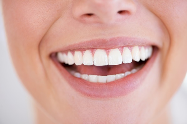 FAQs On Take Home Teeth Whitening Trays