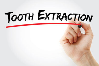 Tooth Extraction Aftercare